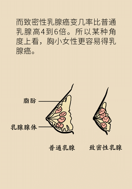 胸小就不會(huì)得乳腺癌嗎？醫(yī)生：患病概率更高