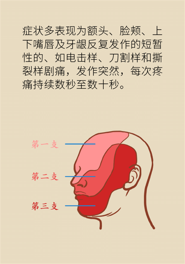 這種疼痛不是牙疼？緩解三叉神經(jīng)痛就用這兩招