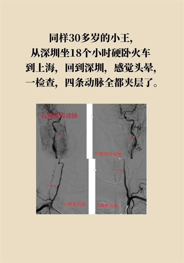 這個(gè)動(dòng)作讓多名年輕人中風(fēng)了，一定要重視！